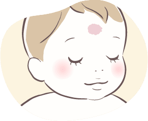 赤あざ