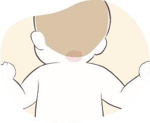 赤あざ